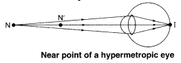 Human Eye and Colourful World Diagram 3