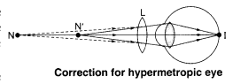 Human Eye and Colourful World Diagram 5
